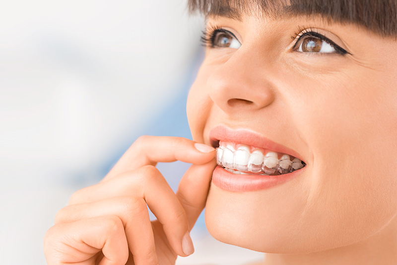 Invisalign in Oradell